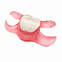 Unilateral Partial Denture