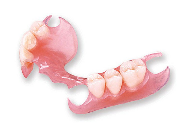 Flexible Partial Denture | Custom Flexible Tooth Replacement
